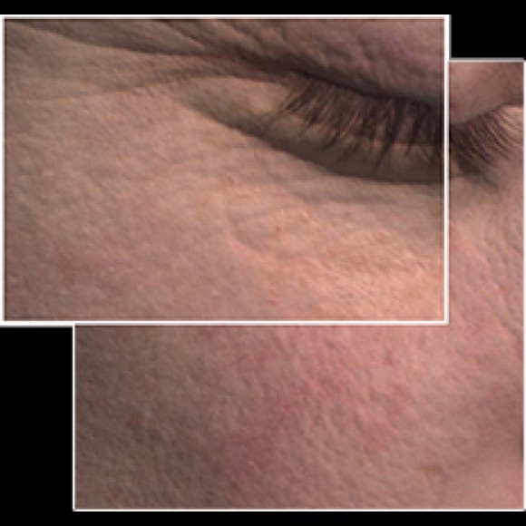 TimeWise® Miracle Set 3D™! - Picture 5 of 6